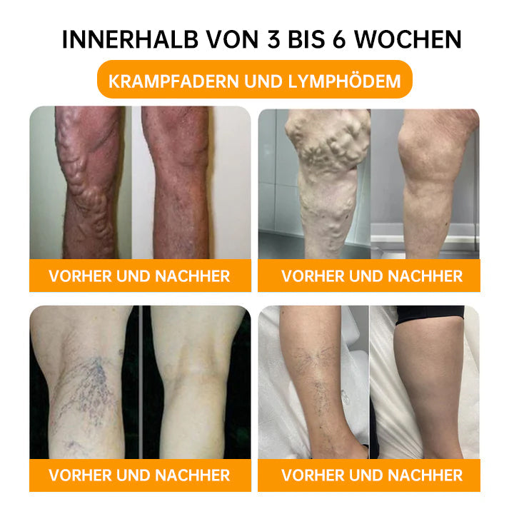 NEGUSY™ 30-Kräuter Schlankheits- und Entgiftungsfußbadperlen - 🦵👩‍⚕️ (LANA-Zertifizierung, Lymphatische Vereinigung von Amerika)