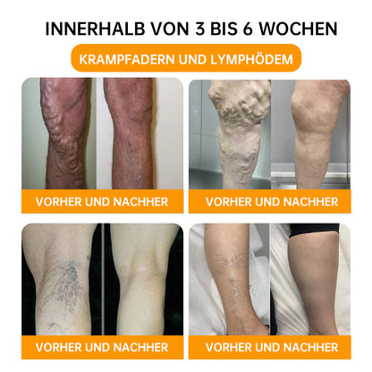 NEGUSY™ 30-Kräuter Schlankheits- und Entgiftungsfußbadperlen - 🦵👩‍⚕️ (LANA-Zertifizierung, Lymphatische Vereinigung von Amerika)