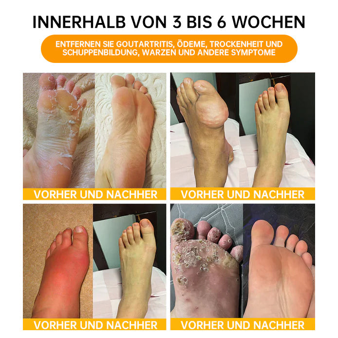 NEGUSY™ 30-Kräuter Schlankheits- und Entgiftungsfußbadperlen - 🦵👩‍⚕️ (LANA-Zertifizierung, Lymphatische Vereinigung von Amerika)