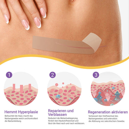 ✅Offizieller Shop |ODEIUN® Hyaluronsäure-Nano-Mikronadel-Reparaturpflaster✴️