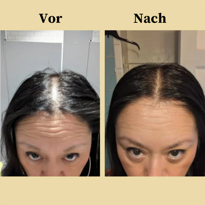 🌿 Natürliches Haarwachstumsöl