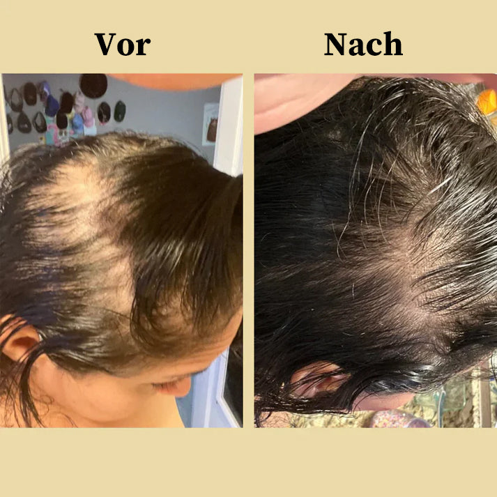 🌿 Natürliches Haarwachstumsöl
