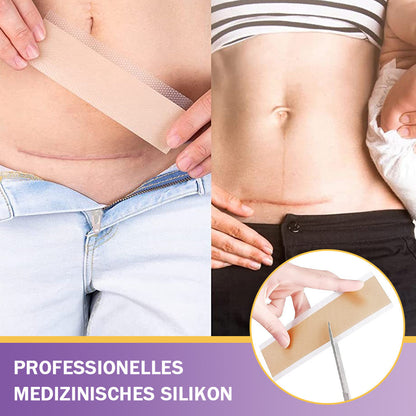 ✅Offizieller Shop |ODEIUN® Hyaluronsäure-Nano-Mikronadel-Reparaturpflaster✴️