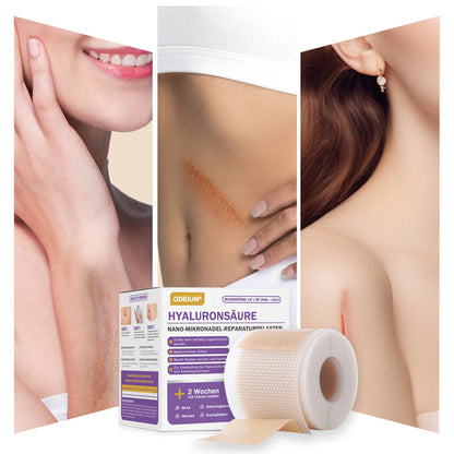 ✅Offizieller Shop |ODEIUN® Hyaluronsäure-Nano-Mikronadel-Reparaturpflaster✴️